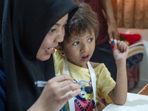 Begini Proses Terapi Wicara Celah Bibir dan Lelangit