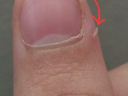 Sederhana Tapi Kejadian Ini Bikin Kamu Marah, Pernah Mengalaminya?