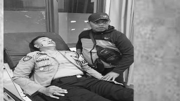 Kapolres Mamberamo Tengah AKBP Rahman usai terkena panah di bagian pipi. (dok. istimewa)