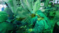Dokter bedah menggunakan sistem robotik da Vinci Xi, yang sebelumnya telah digunakan untuk transplantasi paru-paru tunggal. Operasi ini dipimpin oleh Dr Stephanie H. Chang, profesor madya di Departemen Bedah Kardiotoraks di NYU Grossman School of Medicine. NYU Langone Health/Handout via REUTERS