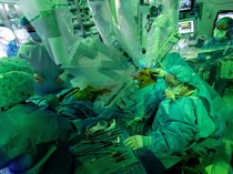 Potret Transplantasi Paru dengan Robot Pertama di Dunia