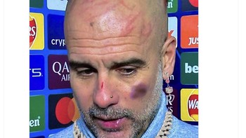 Meme Guardiola yang kini timnya mudah kalah. Foto: X.com