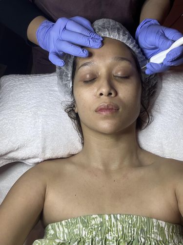 SilkPeel Dermal Infusion di Amala Clinic