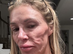 Bintang Reality Show Shock Wajahnya Jadi Penyok, Diduga Ada Parasit