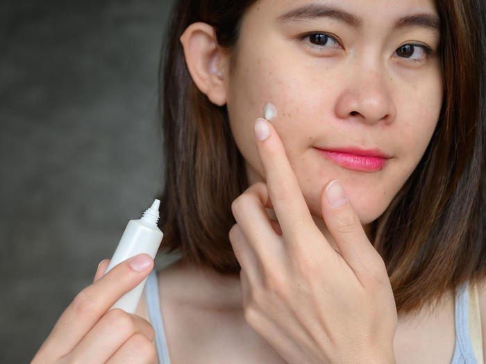 Ilustrasi wanita memakai obat jerawat Ilustrasi wanita memakai obat jerawat