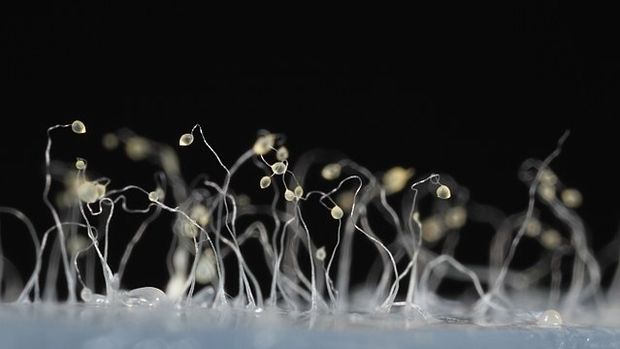 Salah satu contoh acrasiomycota adalah Dictyostelium discoideum.