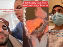 Kronologi Pria Kena Kanker Usus Stadium 4 di Usia 28, Keluhkan Gejala Ini