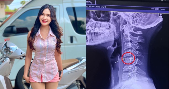 Wanita muda meninggal karena thai massage