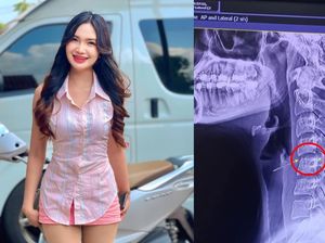 Pilu, Penyanyi Muda Tewas Setelah Pijat Leher di Thailand