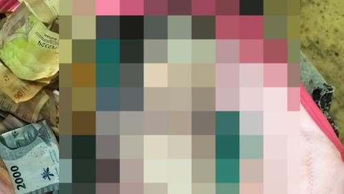 Jasad orok dalam tas belanja yang ditemukan warga Sarung, Badung, saat jalan-jalan sudah dievakuasi ke rumah sakit, Rabu (11/12/2024). (Dok. Polres Badung)