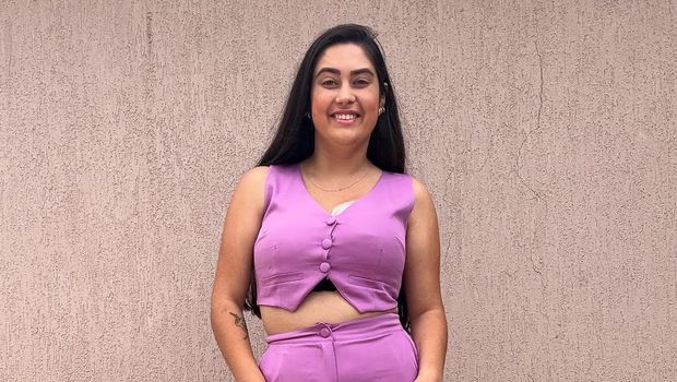 Thaynara Marcondes wanita pengidap gigantomastia.
