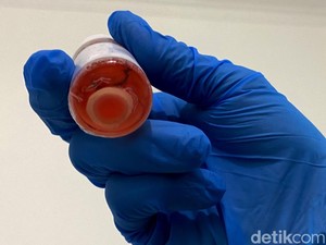Meluruskan Mitos dan Fakta Tentang Donor Mata