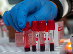 Sebaran Kasus HIV di Indonesia 2025, Ini Pentingnya Edukasi dan Deteksi Dini