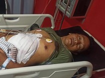 Tantang Orang Duel, Pria di Malang Ini Justru Terkapar Dibacok