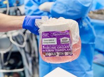 Dokter Bedah AS Uji Klinis Ginjal Babi Hasil Edit Gen untuk Didonorkan ke Manusia