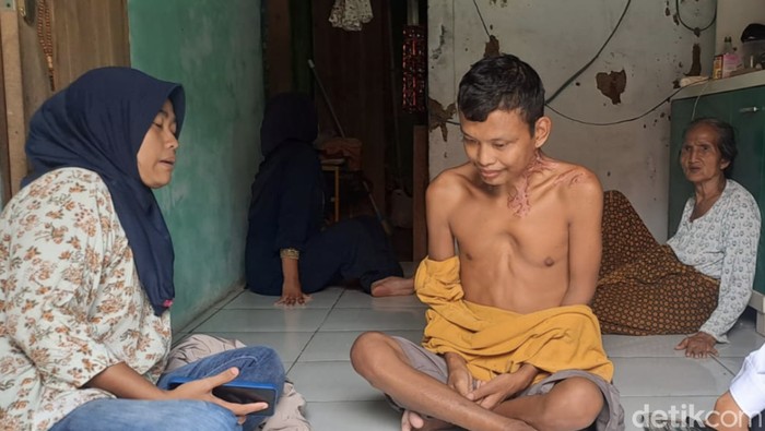 Seorang warga Cilegon, Afendi (28) lehernya tumbuh keloid mirip akar usai mancing di Waduk Krenceng. (M Iqbal/detikcom)
