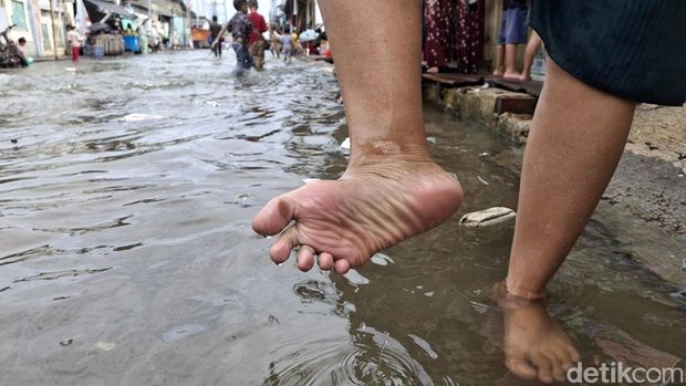 Banjir rob masih terjadi di Muara Angke, Jakut. Imbasnya, kulit telapak kaki warga yang terdampak banjir menjadi mengkerut. (Taufiq Syarifudin/detikcom)