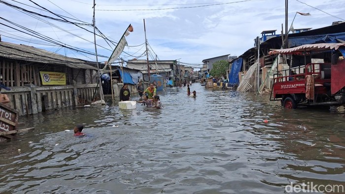Banjir rob masih terjadi di Muara Angke, Jakut. Imbasnya, kulit telapak kaki warga yang terdampak banjir menjadi mengkerut. (Taufiq Syarifudin/detikcom)