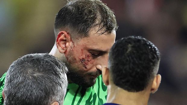 Paris Saint-Germain's Italian goalkeeper #01 Gianluigi Donnarumma (C) receives medical help after sustaining an injury during the French L1 football match between AS Monaco and Paris Saint-Germain at the Louis II Stadium (Stade Louis II) in the Principality of Monaco on December 18, 2024. (Photo by Valery HACHE / AFP)
