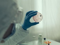 Ilmuwan Temukan Virus Corona Baru di Kelelawar Brasil
