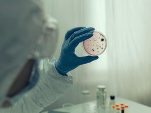 4 Fakta HKU5-CoV-2, Virus Baru yang Mirip COVID-Bisa Menginfeksi Manusia