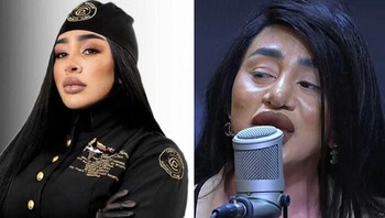 Foto yang dipasang di postingan medsos vs saat tampil. Foto: Demilked