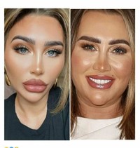 Foto Asli vs Medsos