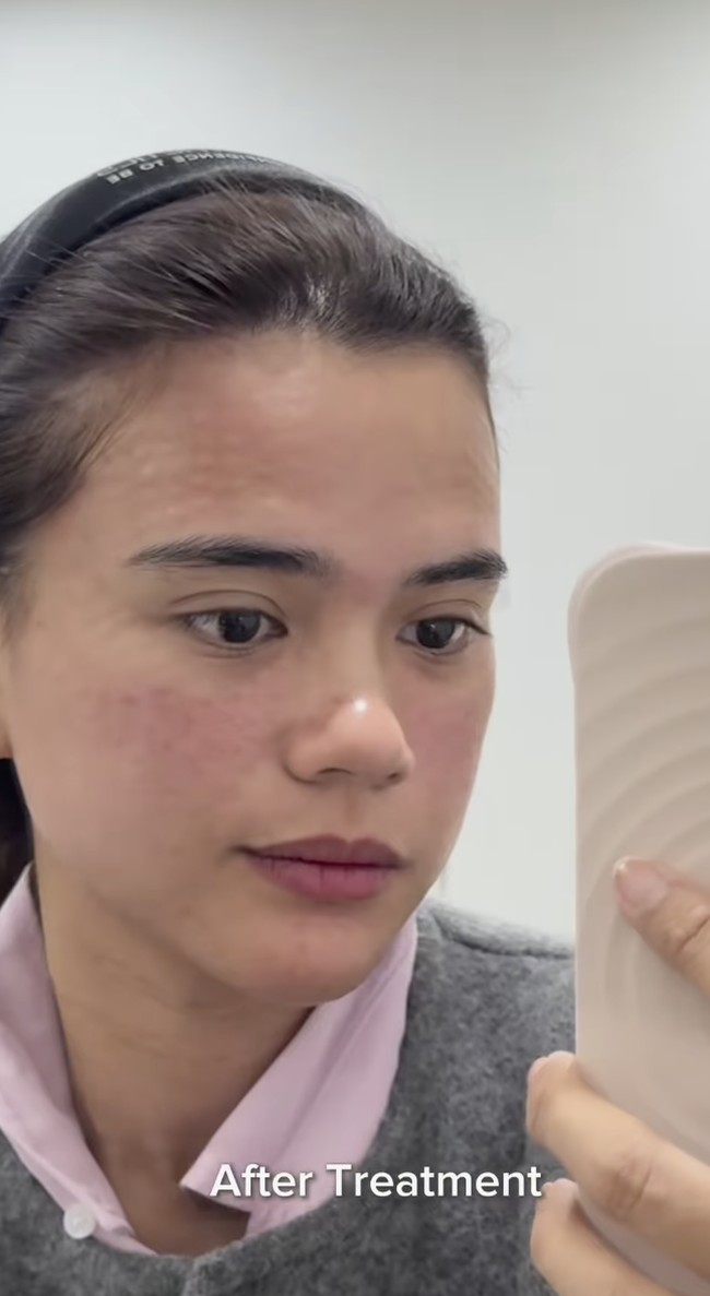 Artis Audi Marissa baru saja membocorkan perawatan wajahnya di Korea Selatan. Tak tanggung-tanggung, Audi menghabiskan biaya hingga Rp 42 juta untuk menjalani serangkaian perawatan kecantikan. Foto: dok. Instagram @audimarissa