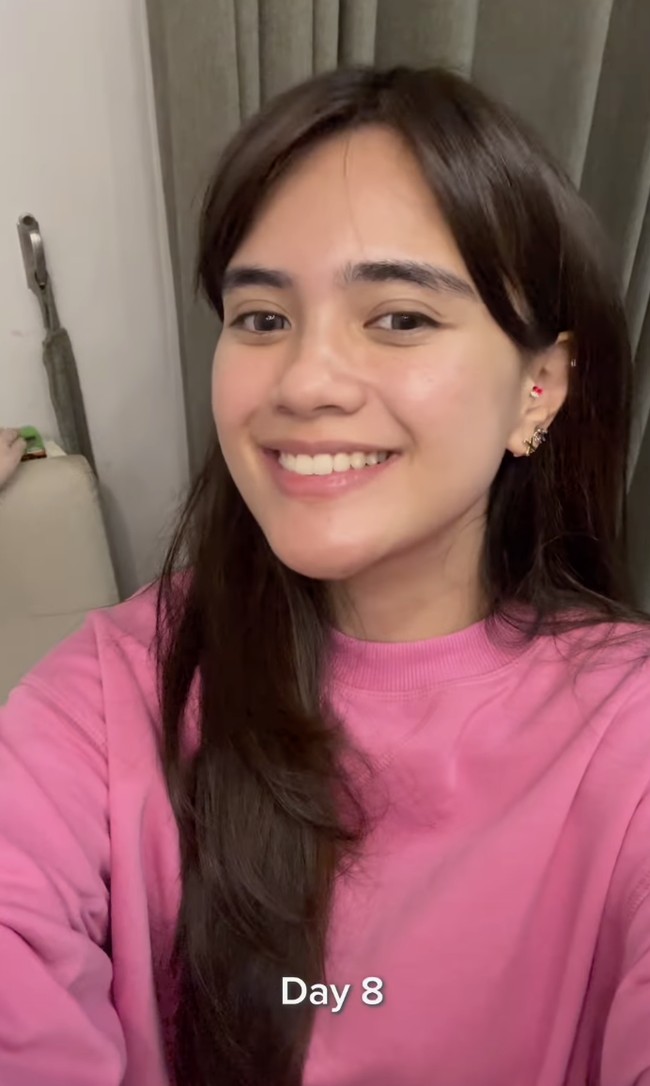 “Kelihatan hasilnya dari hari ke-8, tapi karena aku banyak bekas jerawat jadi lebih terlihat hasilnya di hari ke-11,” tulis Audi dalam unggahannya.  Foto: dok. Instagram @audimarissa