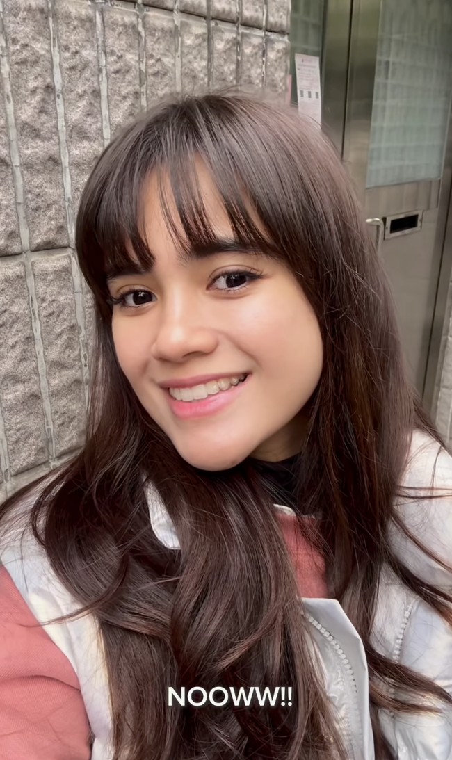 Ia juga menjelaskan bahwa prosedur seperti botox rahang dan thermage memberikan efek wajah lebih kecil dan tirus tanpa harus melalui proses operasi. Meski Audi mengaku bahwa beberapa prosedur memberikan rasa sakit, ia sangat puas dengan hasil akhirnya Foto: dok. Instagram @audimarissa