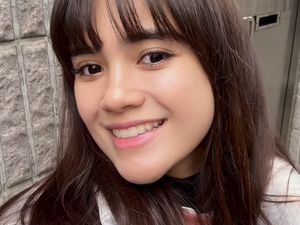 Most Pop: Foto Before-After Audi Marissa Perawatan Rp 42 Juta di Korea