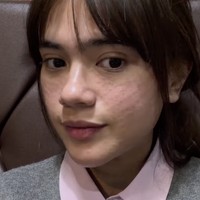 Audi menjalani tujuh perawatan wajah: Thermage, Juvelook Skin, Botox Lifting, Botox Rahang, Shrink Universe, Filler Leher, dan Laser Hair Removal. Foto: dok. Instagram @audimarissa