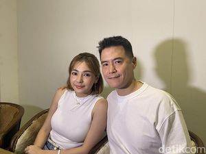 Blak-blakan Maya Septha Oplas Mata dan Hidung