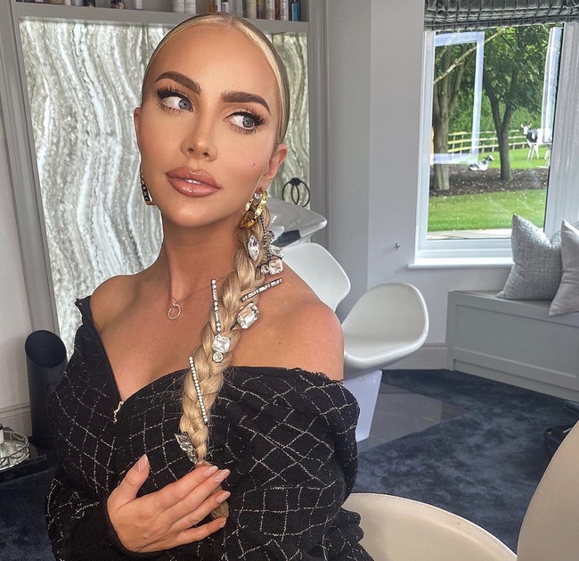 Kondisi ini membuatnya mempertimbangkan prosedur facelift, meskipun usianya baru 34 tahun. Banyak dokter sempat menolak keinginannya karena usia yang relatif muda untuk prosedur tersebut. Namun, setelah bertahun-tahun mencari, Stobart menemukan ahli bedah plastik yang bersedia melakukannya. Foto: dok. Instagram @thecosmeticconsult