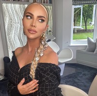 Kondisi ini membuatnya mempertimbangkan prosedur facelift, meskipun usianya baru 34 tahun. Banyak dokter sempat menolak keinginannya karena usia yang relatif muda untuk prosedur tersebut. Namun, setelah bertahun-tahun mencari, Stobart menemukan ahli bedah plastik yang bersedia melakukannya. Foto: dok. Instagram @thecosmeticconsult