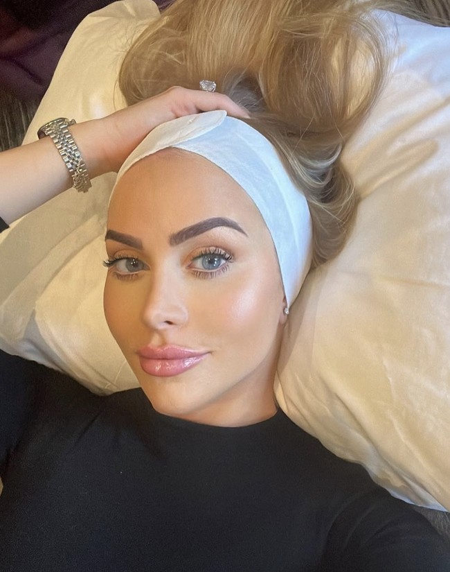 Meskipun banyak pujian untuk hasil operasinya, keputusan Stobart juga menuai kritik, terutama dari mereka yang menganggap facelift di usia 34 tahun sebagai langkah ekstrem. Namun, Stobart menegaskan bahwa itu adalah pilihannya sendiri. Ini uang saya, keputusan saya, dan saya memastikan untuk melakukannya dengan aman. Tidak ada yang salah dengan itu, tegasnya. Foto: dok. Instagram @thecosmeticconsult