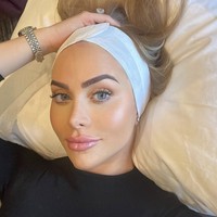 Meskipun banyak pujian untuk hasil operasinya, keputusan Stobart juga menuai kritik, terutama dari mereka yang menganggap facelift di usia 34 tahun sebagai langkah ekstrem. Namun, Stobart menegaskan bahwa itu adalah pilihannya sendiri. Ini uang saya, keputusan saya, dan saya memastikan untuk melakukannya dengan aman. Tidak ada yang salah dengan itu, tegasnya. Foto: dok. Instagram @thecosmeticconsult