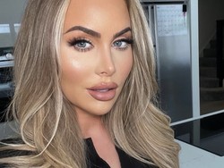 Kebanyakan Filler & Operasi Plastik, Wajah Wanita Ini Tak Dikenali di Bandara