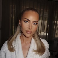 Dalam operasi yang berlangsung selama sembilan jam, dokter menghilangkan filler yang tersisa di wajahnya dan mengencangkan kulit kendur di sekitar rahang dan mulut. Foto: dok. Instagram @thecosmeticconsult