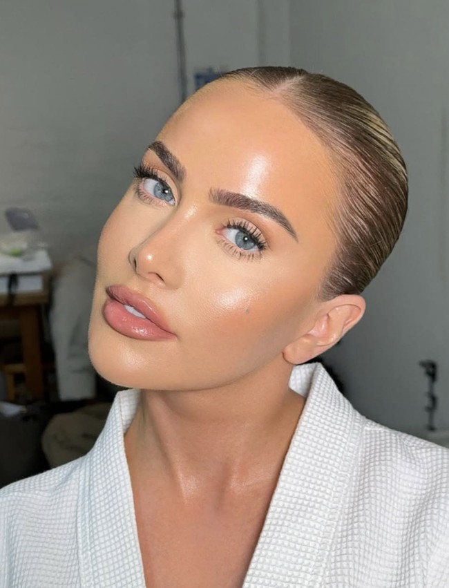 Dokter mengeluarkan filler yang sudah berubah warna menjadi hijau selama berjam-jam. Akhirnya, saya sangat puas dengan hasilnya, ujarnya di podcast ‘So Wrong It’s Right’. Foto: dok. Instagram @thecosmeticconsult