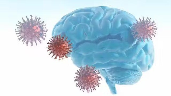 Riset Terbaru: COVID-19 Bisa Bikin IQ Turun Permanen
