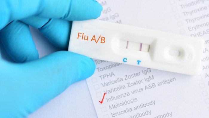 Influenza A/B positive test result by using rapid test cassette