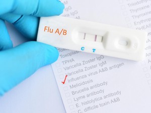 Kemenkes Ingatkan RI Dibayangi Kenaikan Influenza A, Mulai Ngegas di Asia Tenggara