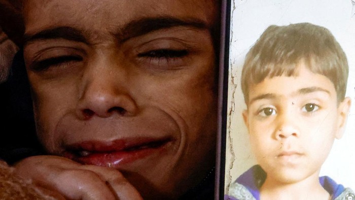 A malnourished Palestinian child examined by Gregory Shay, a retired pediatric pulmonologist, reacts in Khan Younis, southern Gaza Strip in this picture said to be taken in October, 2024. Gregory Shay/Handout via REUTERS   THIS IMAGE HAS BEEN SUPPLIED BY A THIRD PARTY NO RESALES. NO ARCHIVES