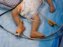 Video: Kasus Meningitis pada Anak-anak di Gaza Meningkat!