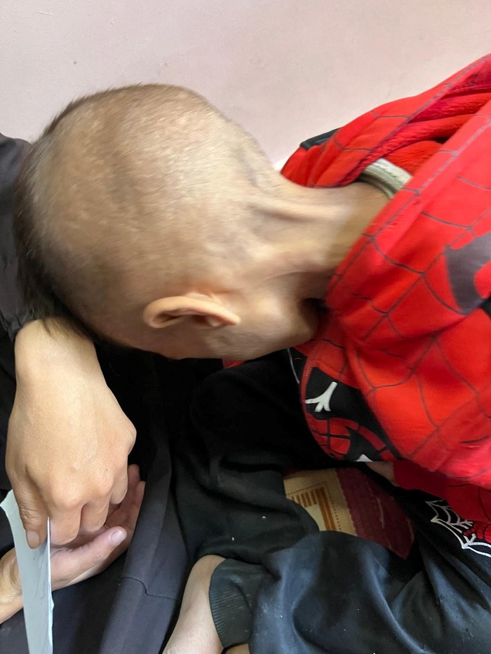 A malnourished Palestinian child examined by Gregory Shay, a retired pediatric pulmonologist, reacts in Khan Younis, southern Gaza Strip in this picture said to be taken in October, 2024. Gregory Shay/Handout via REUTERS   THIS IMAGE HAS BEEN SUPPLIED BY A THIRD PARTY NO RESALES. NO ARCHIVES