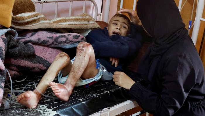 A malnourished Palestinian child examined by Gregory Shay, a retired pediatric pulmonologist, reacts in Khan Younis, southern Gaza Strip in this picture said to be taken in October, 2024. Gregory Shay/Handout via REUTERS THIS IMAGE HAS BEEN SUPPLIED BY A THIRD PARTY NO RESALES. NO ARCHIVES