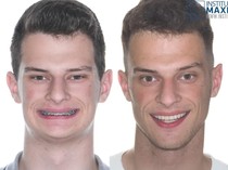 Pria Umur 18 Tahun Jalani Operasi Plastik, Before-Afternya bak Beda Orang