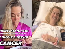 Curhat Wanita Korban Salah Diagnosis, Dikira Sakit Kulit Ternyata Kena Kanker