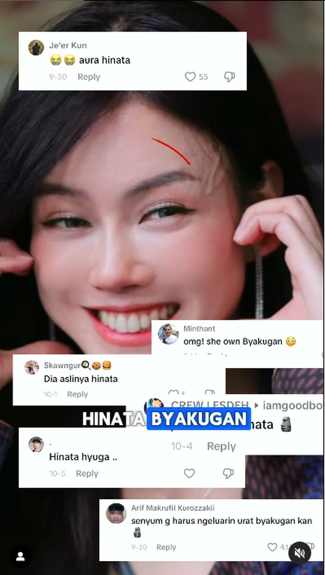 Dikatakan jika Nita turun berat badan cukup drastis sampai membuat area wajahnya kempot, banyak cekungan, dan terlihat urat-urat di bagian dahinya. Apalagi di Instagram, banyak yang menyebutnya mirip Hinata di serial Naruto dan punya ‘byakugan’. Foto: Instagram Nita Gunawan